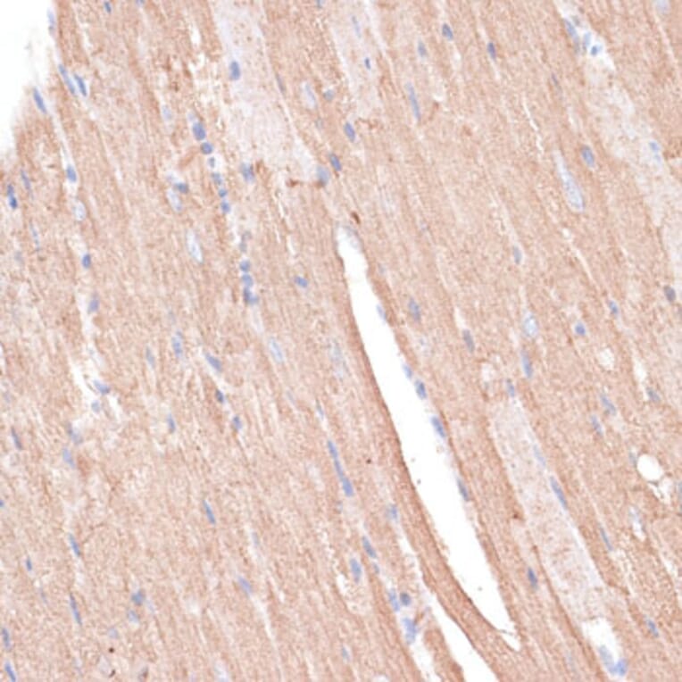 Immunohistochemistry - Anti-KCNK1 Antibody (A12835) - Antibodies.com