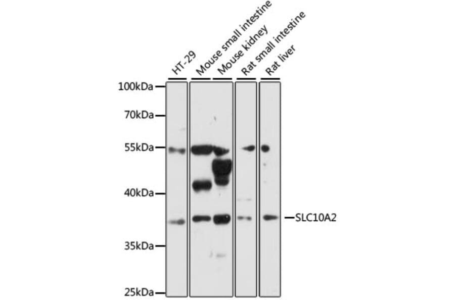 Western Blot - Anti-SLC10A2/ASBT Antibody (A89658) - Antibodies.com