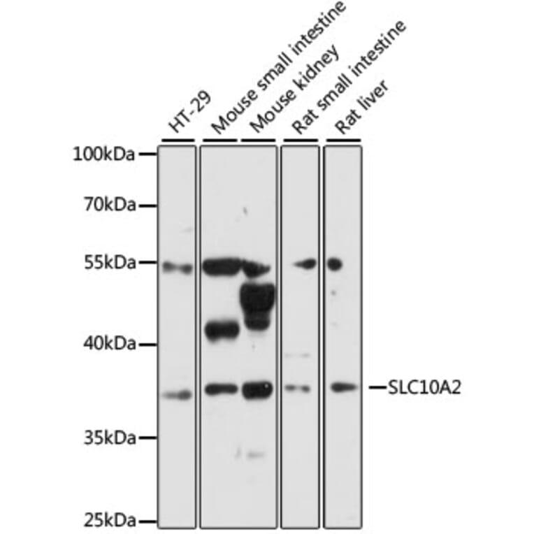 Western Blot - Anti-SLC10A2/ASBT Antibody (A89658) - Antibodies.com