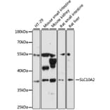 Western Blot - Anti-SLC10A2/ASBT Antibody (A89658) - Antibodies.com