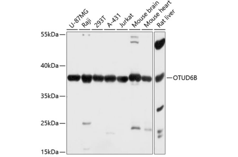 Western Blot - Anti-OTUD6B Antibody (A89659) - Antibodies.com