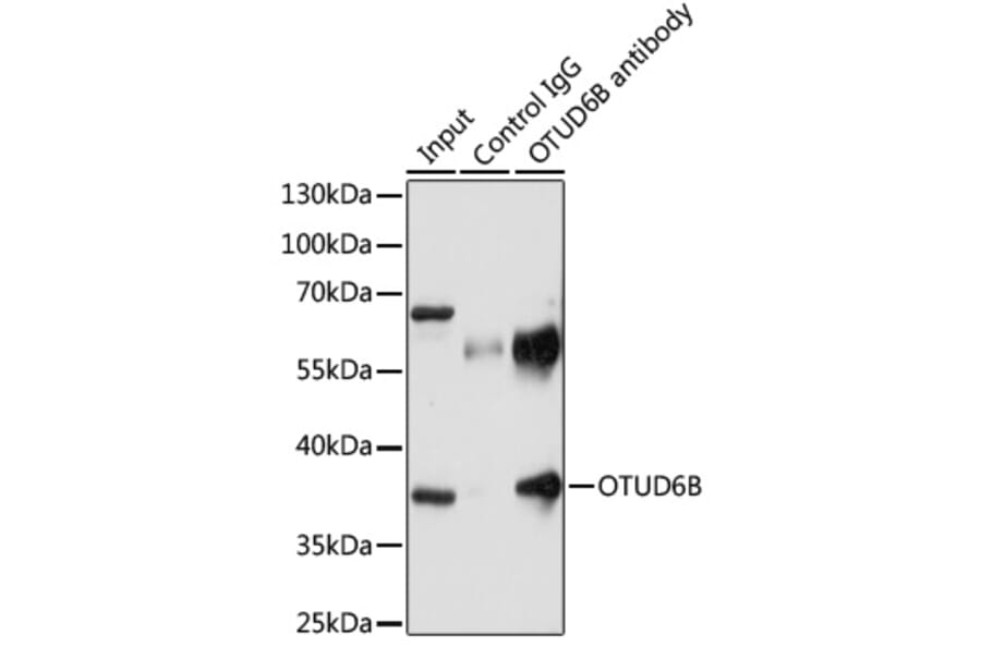 Western Blot - Anti-OTUD6B Antibody (A89659) - Antibodies.com