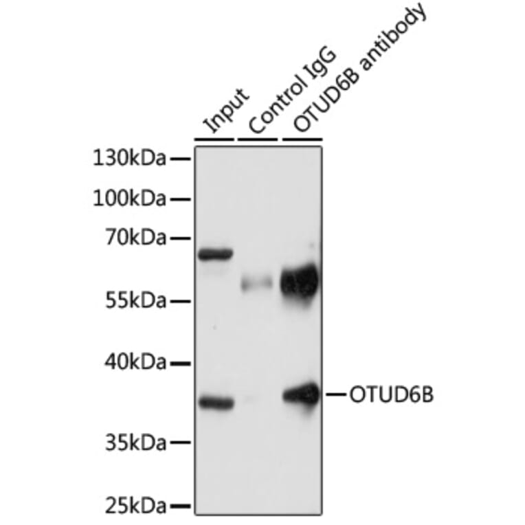 Western Blot - Anti-OTUD6B Antibody (A89659) - Antibodies.com