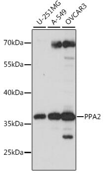 Western blot analysis of extracts of various cell lines, using Anti-PPA2 Antibody (A15819) at 1:1,000 dilution.
Secondary antibody: Goat Anti-Rabbit IgG (H+L) (HRP) (AS014) at 1:10,000 dilution.
Lysates / proteins: 25µg per lane.
Blocking buffer: 3% non-fat dry milk in TBST.
Detection: ECL Basic Kit (RM00020).
Exposure time: 10s.