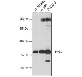 Western Blot - Anti-PPA2 Antibody (A89661) - Antibodies.com