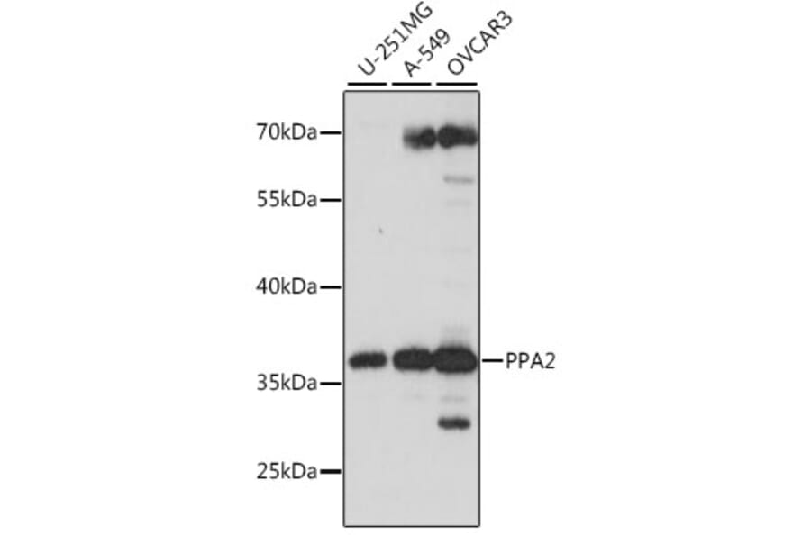 Western Blot - Anti-PPA2 Antibody (A89661) - Antibodies.com