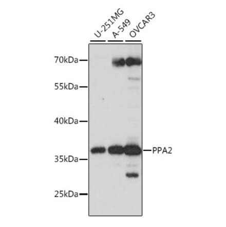 Western Blot - Anti-PPA2 Antibody (A89661) - Antibodies.com