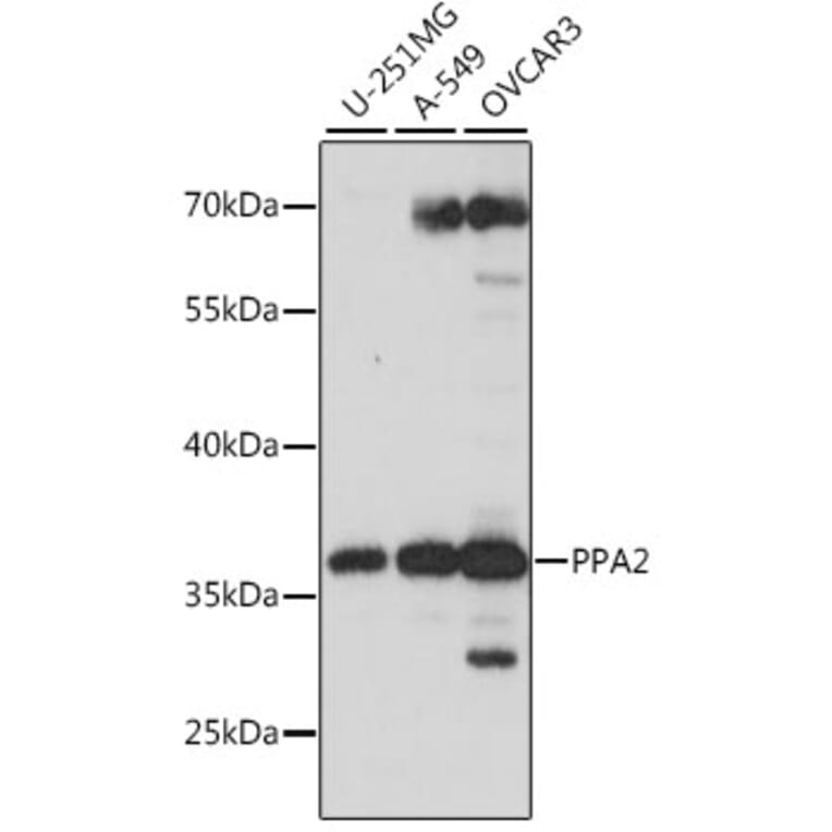 Western Blot - Anti-PPA2 Antibody (A89661) - Antibodies.com