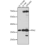 Western Blot - Anti-PPA2 Antibody (A89661) - Antibodies.com