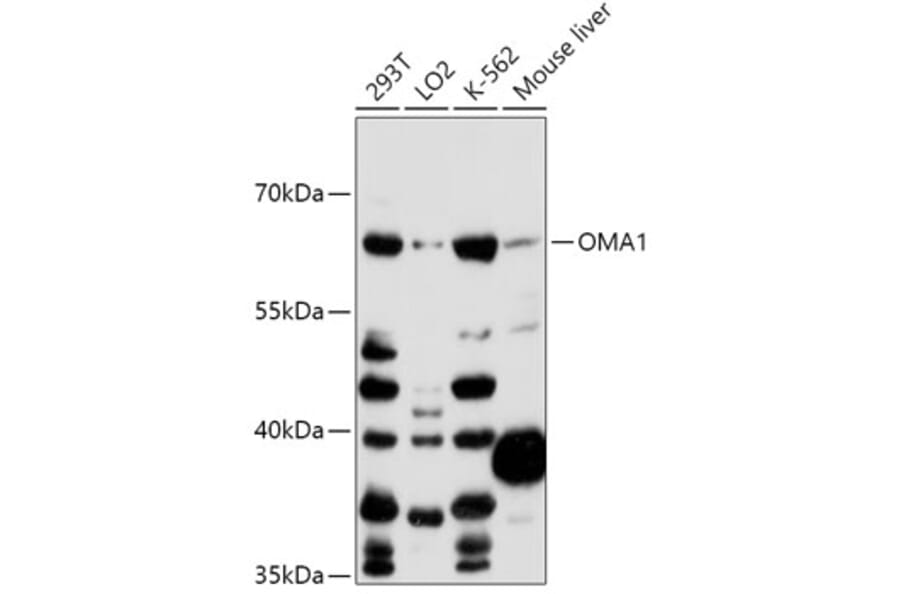 Western Blot - Anti-OMA1 Antibody (A89662) - Antibodies.com
