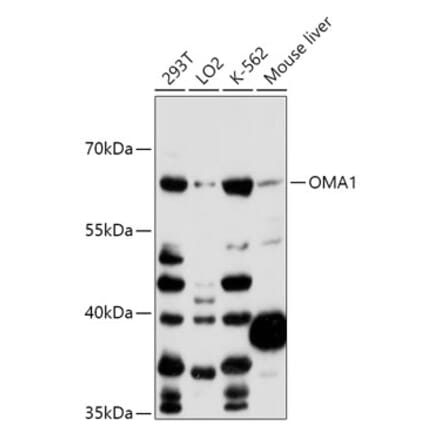 Western Blot - Anti-OMA1 Antibody (A89662) - Antibodies.com