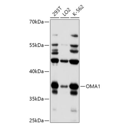 Western Blot - Anti-OMA1 Antibody (A89663) - Antibodies.com