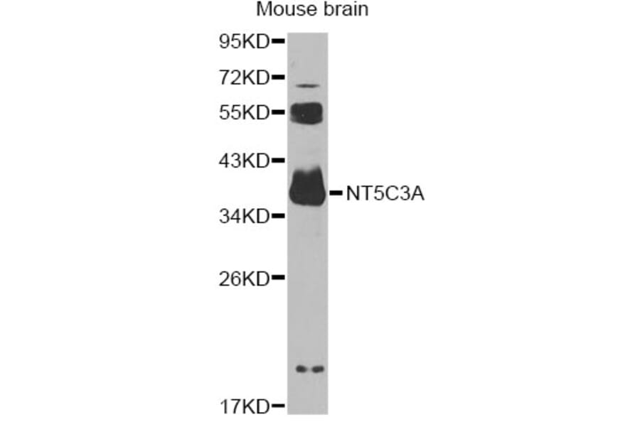 Western Blot - Anti-NT5C3A Antibody (A14127) - Antibodies.com