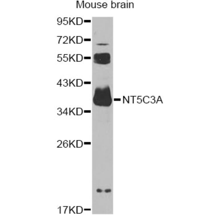 Western Blot - Anti-NT5C3A Antibody (A14127) - Antibodies.com