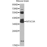 Western Blot - Anti-NT5C3A Antibody (A14127) - Antibodies.com