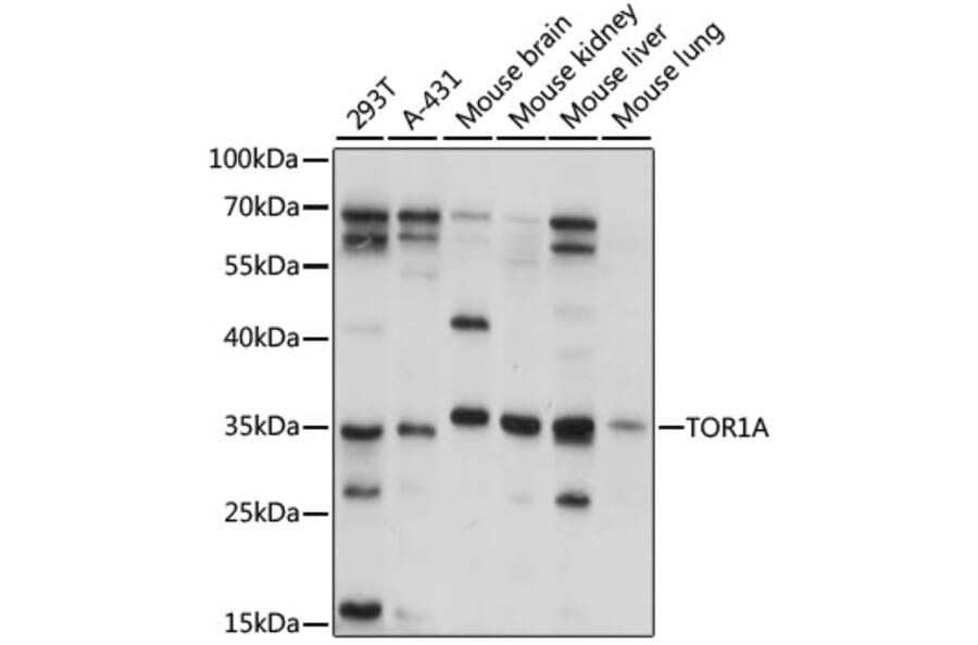 Western Blot - Anti-TOR1A Antibody (A15051) - Antibodies.com