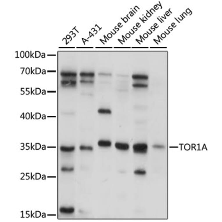 Western Blot - Anti-TOR1A Antibody (A15051) - Antibodies.com