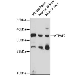 Western Blot - Anti-ATPAF2 Antibody (A89666) - Antibodies.com