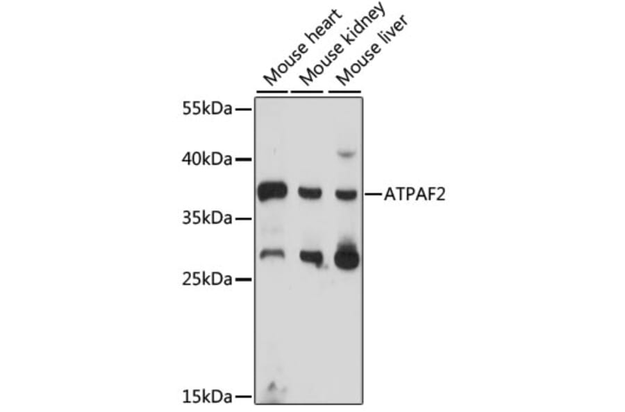 Western Blot - Anti-ATPAF2 Antibody (A89666) - Antibodies.com