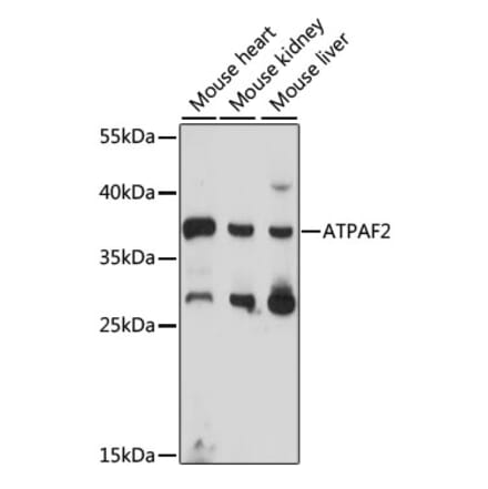 Western Blot - Anti-ATPAF2 Antibody (A89666) - Antibodies.com