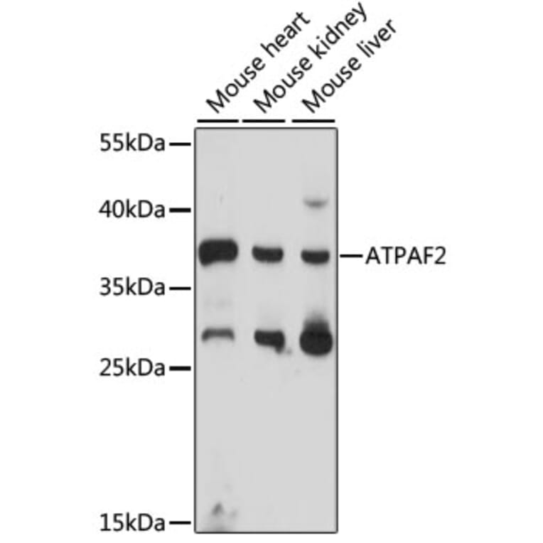 Western Blot - Anti-ATPAF2 Antibody (A89666) - Antibodies.com