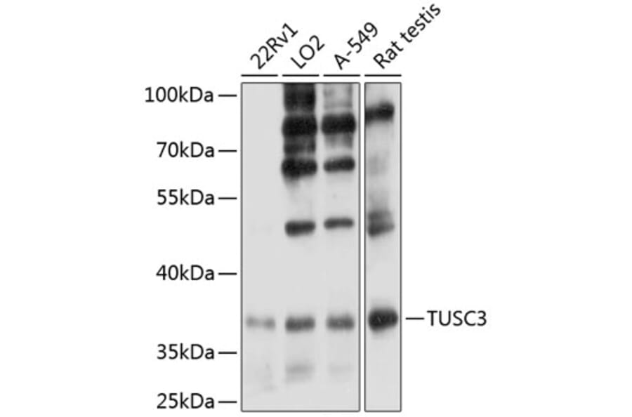 Western Blot - Anti-TUSC3 Antibody (A12571) - Antibodies.com