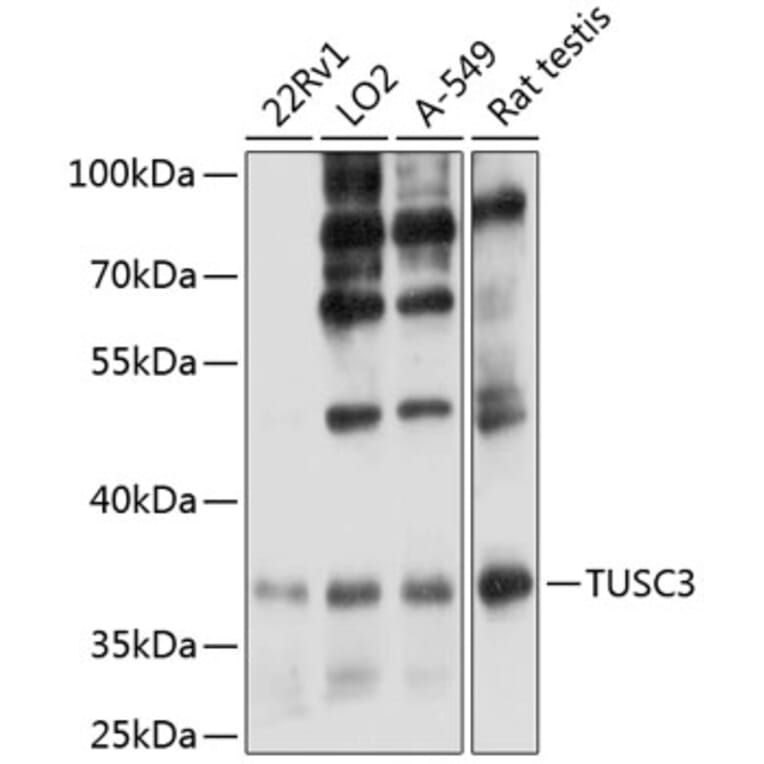 Western Blot - Anti-TUSC3 Antibody (A12571) - Antibodies.com