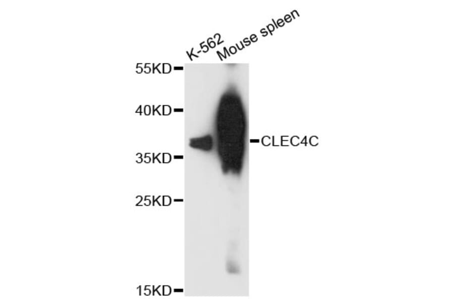 Western Blot - Anti-CLEC4C Antibody (A13702) - Antibodies.com