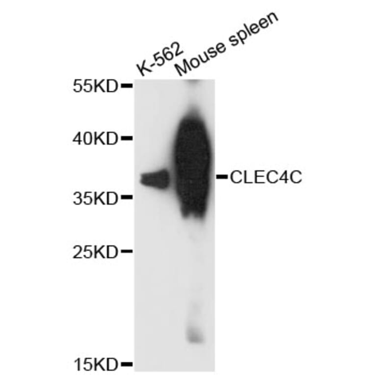 Western Blot - Anti-CLEC4C Antibody (A13702) - Antibodies.com