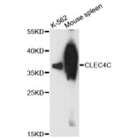 Western Blot - Anti-CLEC4C Antibody (A13702) - Antibodies.com
