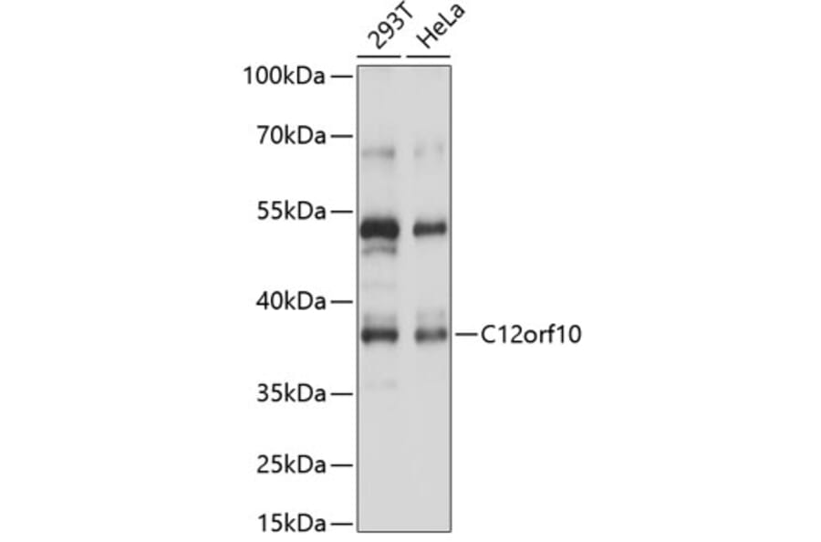 Western Blot - Anti-C12orf10 Antibody (A89669) - Antibodies.com
