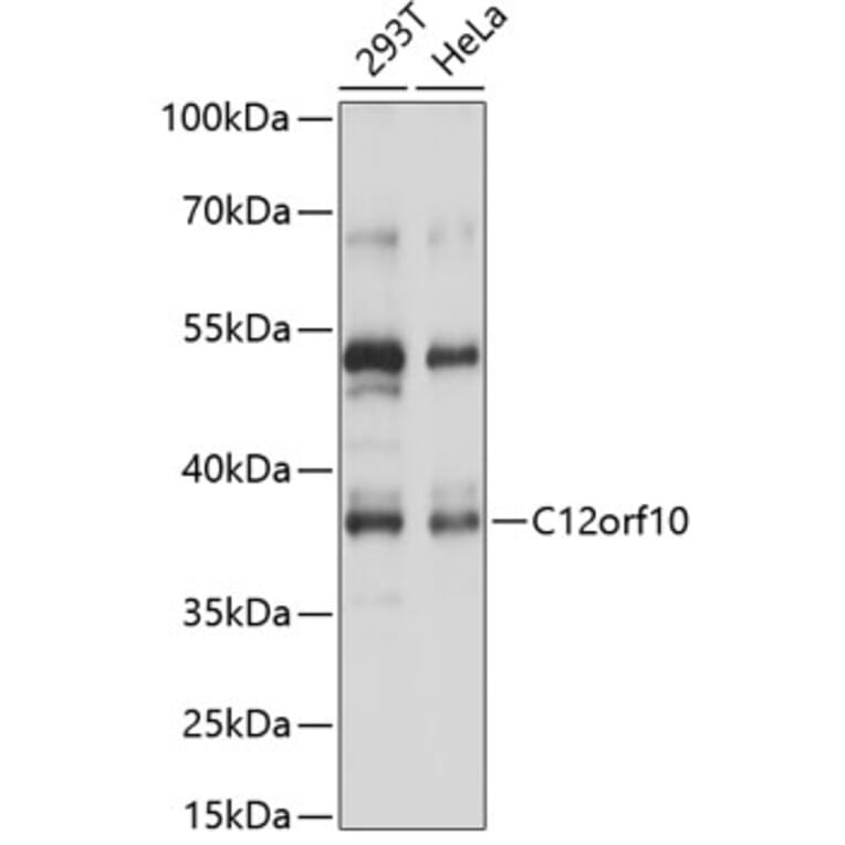 Western Blot - Anti-C12orf10 Antibody (A89669) - Antibodies.com