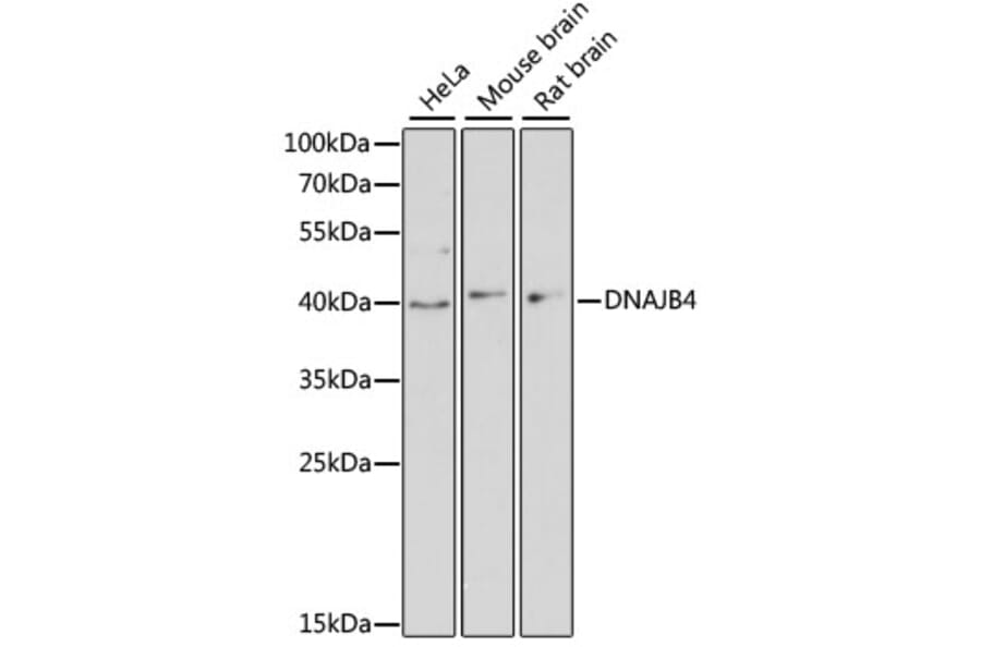 Western Blot - Anti-DNAJB4 Antibody (A13076) - Antibodies.com