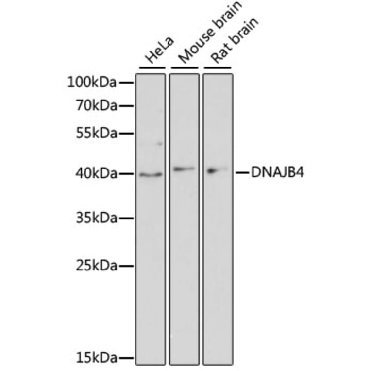 Western Blot - Anti-DNAJB4 Antibody (A13076) - Antibodies.com