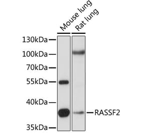 Western Blot - Anti-RASSF2 Antibody (A89671) - Antibodies.com
