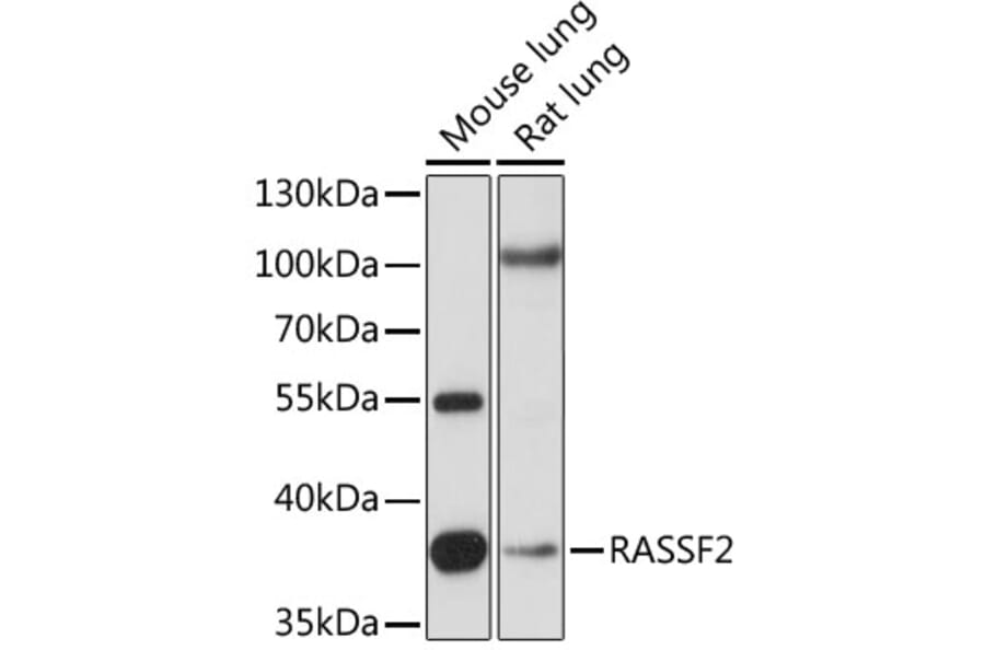 Western Blot - Anti-RASSF2 Antibody (A89671) - Antibodies.com