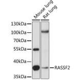 Western Blot - Anti-RASSF2 Antibody (A89671) - Antibodies.com