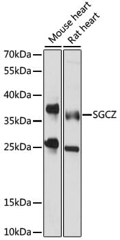 Western blot analysis of extracts of various cell lines, using Anti-SGCZ Antibody (A15958) at 1000 dilution.
Secondary antibody: Goat Anti-Rabbit IgG (H+L) (HRP) (AS014) at 1:10,000 dilution.
Lysates / proteins: 25µg per lane.
Blocking buffer: 3% non-fat dry milk in TBST.
Detection: ECL Basic Kit (RM00020).
Exposure time: 15s.