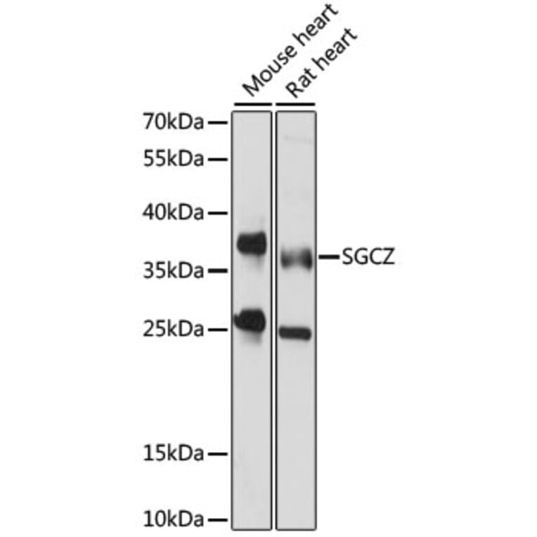 Western Blot - Anti-SGCZ Antibody (A89672) - Antibodies.com