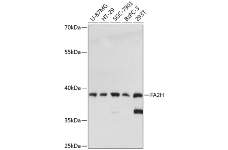 Western Blot - Anti-FA2H Antibody (A89673) - Antibodies.com