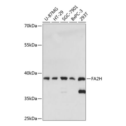 Western Blot - Anti-FA2H Antibody (A89673) - Antibodies.com