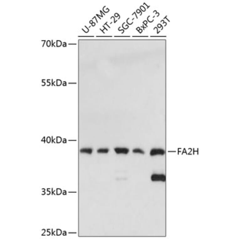 Western Blot - Anti-FA2H Antibody (A89673) - Antibodies.com