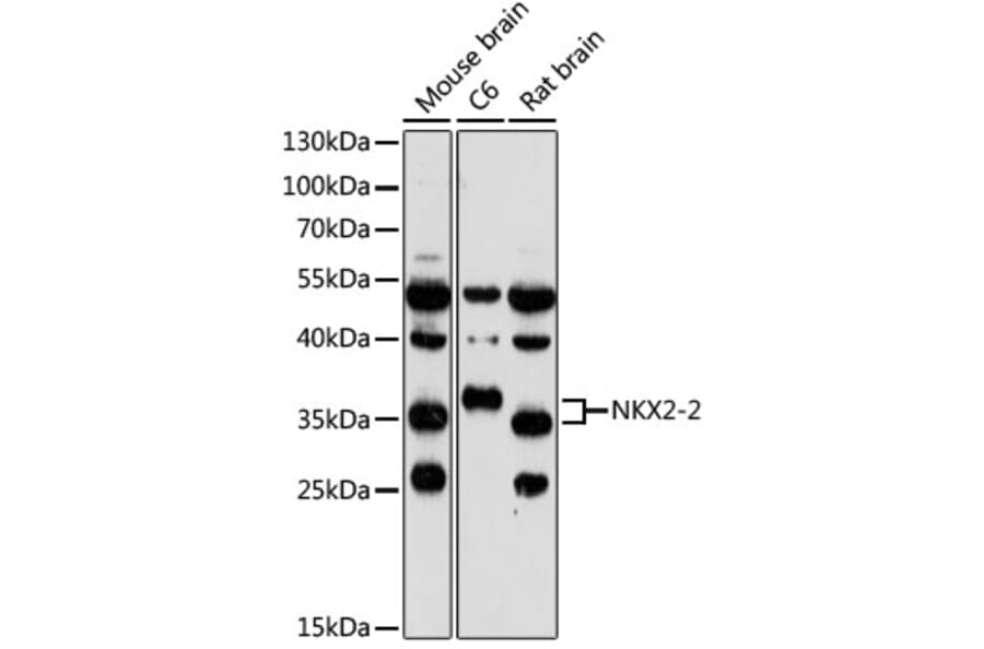 Western Blot - Anti-Nkx2.2 Antibody (A89674) - Antibodies.com