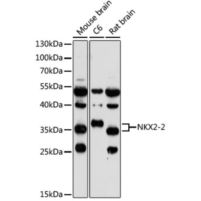 Western Blot - Anti-Nkx2.2 Antibody (A89674) - Antibodies.com