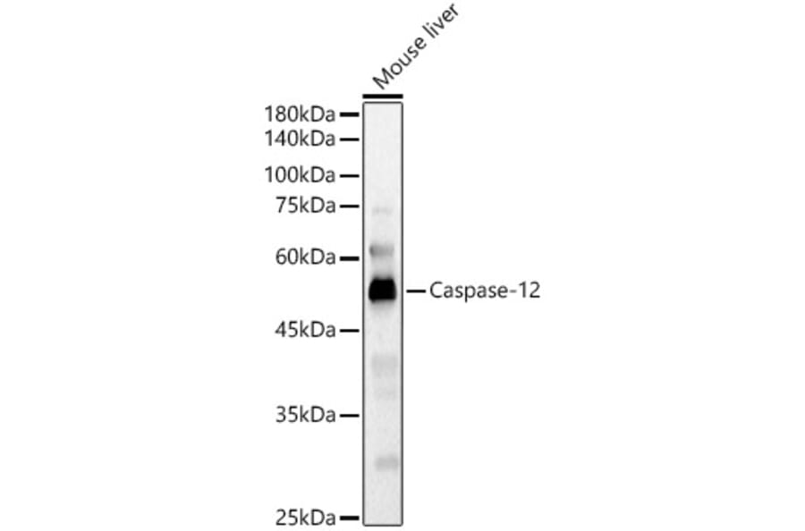 Western Blot - Anti-Caspase-12 Antibody (A89676) - Antibodies.com