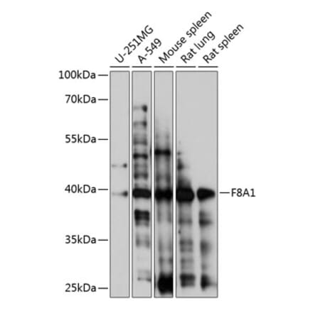 Western Blot - Anti-HAP40 Antibody (A89677) - Antibodies.com