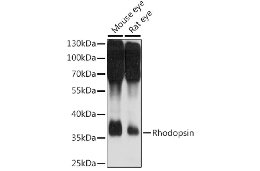 Western Blot - Anti-Rhodopsin Antibody (A89678) - Antibodies.com