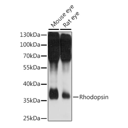 Western Blot - Anti-Rhodopsin Antibody (A89678) - Antibodies.com