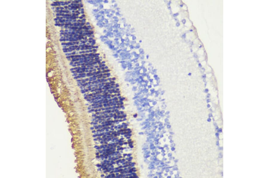 Immunohistochemistry - Anti-Rhodopsin Antibody (A89678) - Antibodies.com