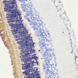 Immunohistochemistry - Anti-Rhodopsin Antibody (A89678) - Antibodies.com